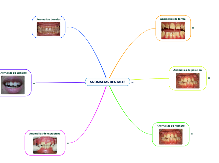 Anomalias Dentales Mind Map